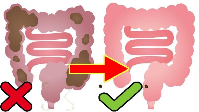 Difficile à croire : ce remède naturel nettoie votre colon en 24 heures…