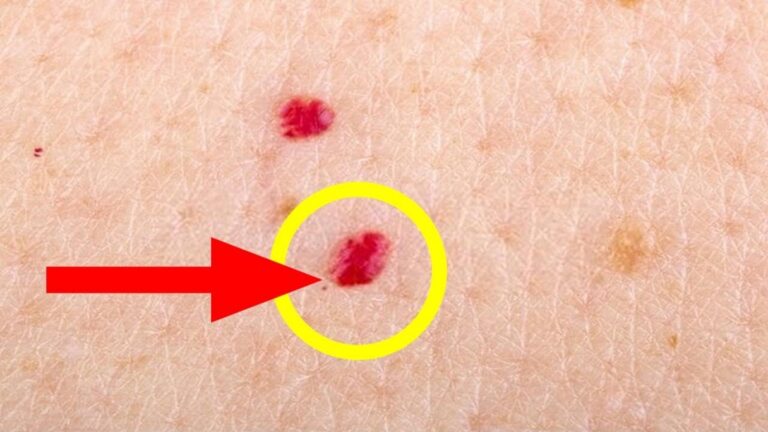 Incroyable… Ces simples gestes éliminent les points rouges pour une peau parfaite !