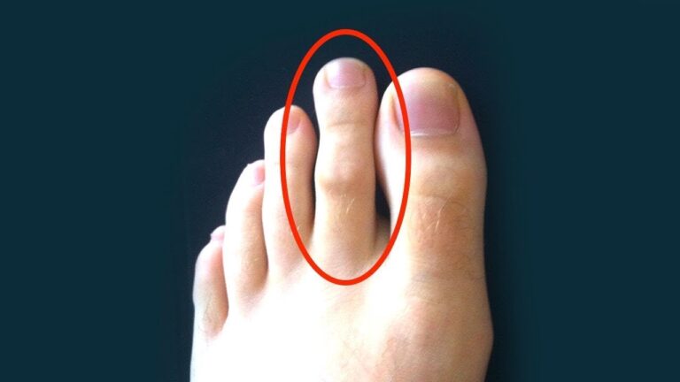 4 conseils pour prendre soin de tes pieds et éviter les douleurs !