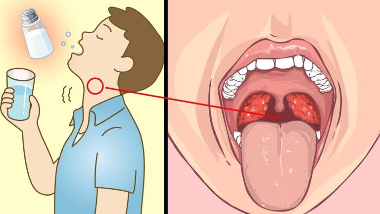 Transformez votre santé avec 7 jours de gargarismes à l&rsquo;eau salée !
