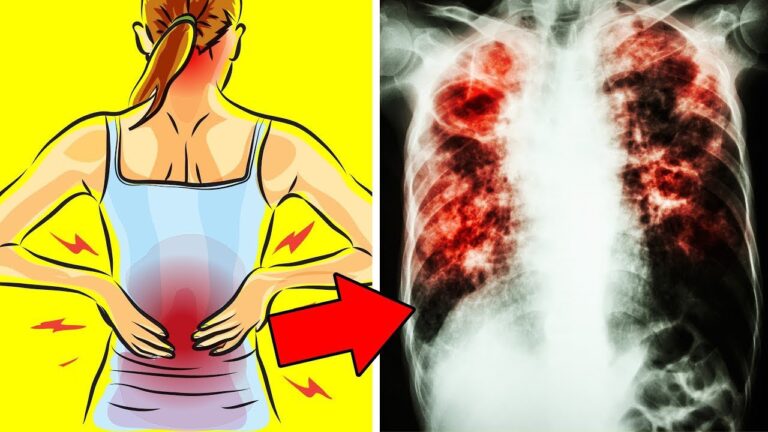 8 Signes Que Vos Poumons Ont Besoin d&rsquo;Aide : Protégez Votre Santé Dès Maintenant !