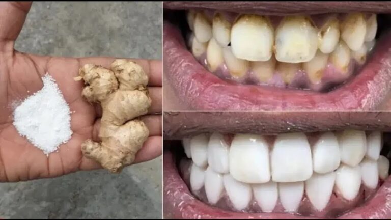 6 astuces simples pour des dents plus blanches en quelques minutes !