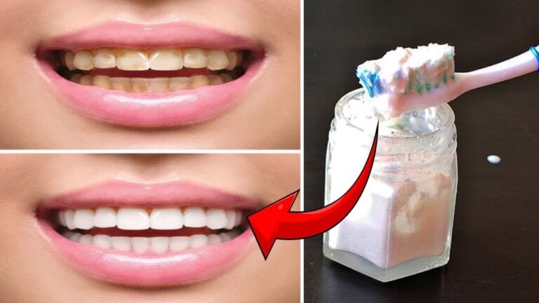 5 astuces pour retrouver des dents blanches rapidement et naturellement