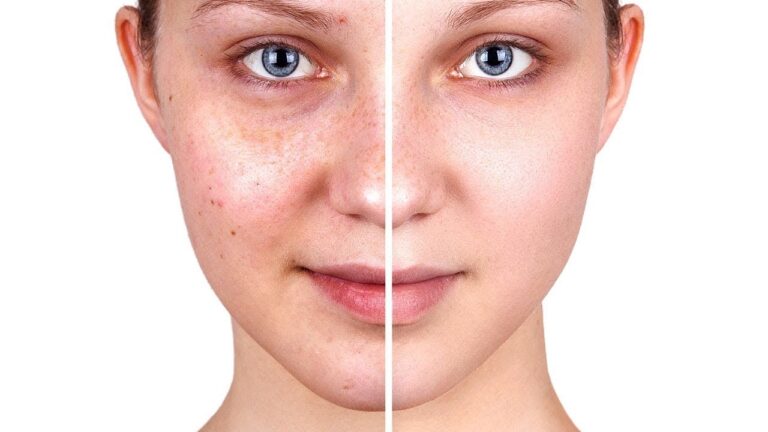 5 astuces pour une peau radieuse et éclatante au quotidien !