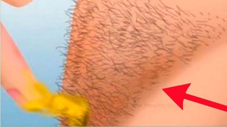 5 méthodes naturelles pour dire adieu aux poils indésirables !
