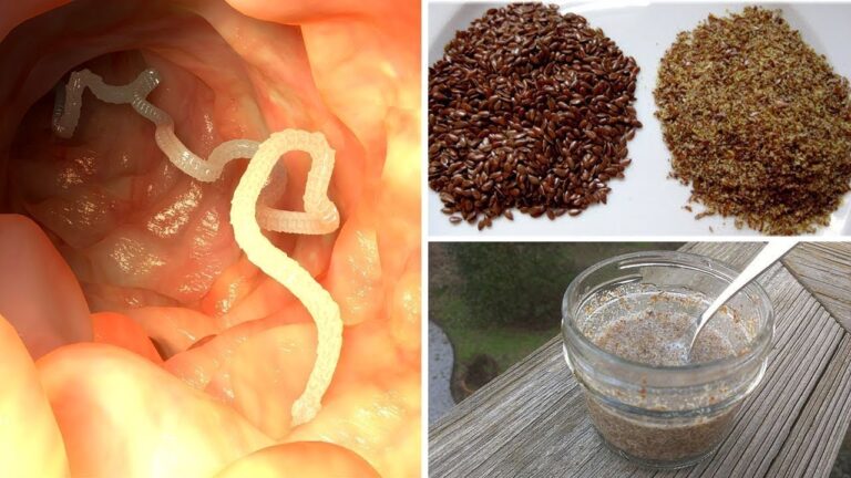 5 astuces naturelles pour éliminer les parasites intestinaux facilement !