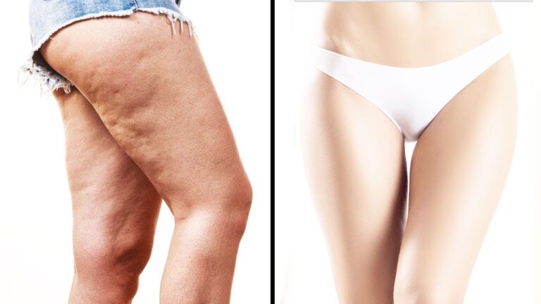 5 astuces pour obtenir des cuisses magnifiques sans effort