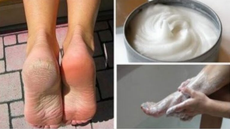 Élimine 5 problèmes de pieds avec cet incroyable remède maison efficace !