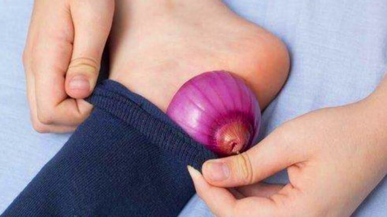 5 astuces efficaces pour éliminer le mycose des ongles en une nuit