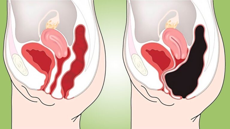 5 recettes de smoothies pour détoxifier naturellement votre colon à la maison