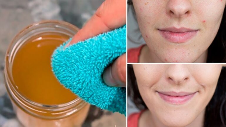 Transforme ta peau en 5 jours avec de l&rsquo;acide de pomme et découvre les résultats incroyables !