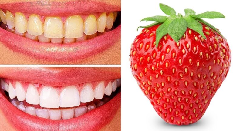 Blanchissez vos dents en 5 minutes avec ce recette simple et efficace !