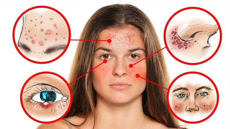 10 signes sur votre visage qui révèlent des problèmes de santé à ne pas ignorer!