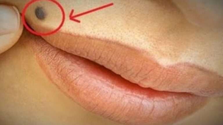 Découvrez la signification de 7 moles sur votre corps et ce qu&rsquo;ils révèlent sur vous !