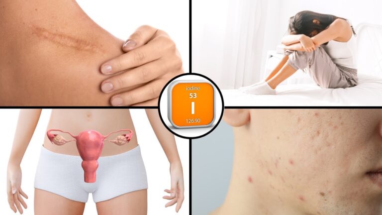 5 avantages surprenants du jod à découvrir absolument !