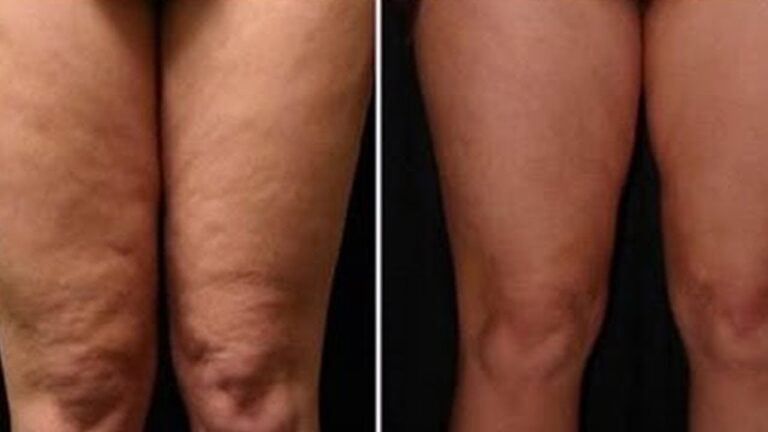 Découvrez 5 astuces surprenantes pour sublimer vos jambes en un clin d&rsquo;œil !