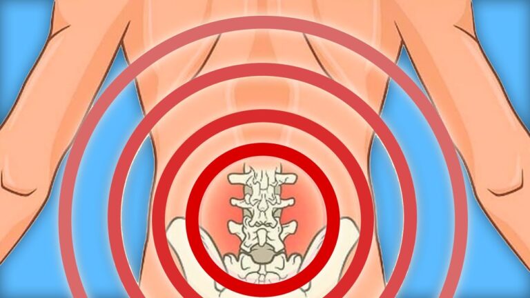 5 astuces incontournables pour apaiser les douleurs au coccyx efficacement !